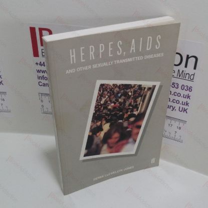 Picture of Herpes, AIDS and Other Sexually Transmitted Diseases