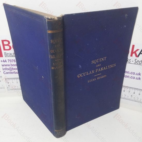 Picture of Squint and Ocular Paralysis, with a Short Account of the Disturbances of Muscle Balance