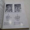 Picture of Examination of the Hand and Wrist